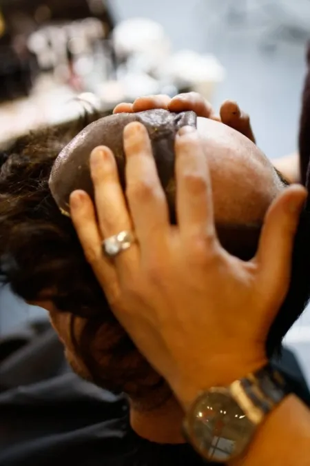 Haarsystem für Männer – natürlicher Haaransatz
